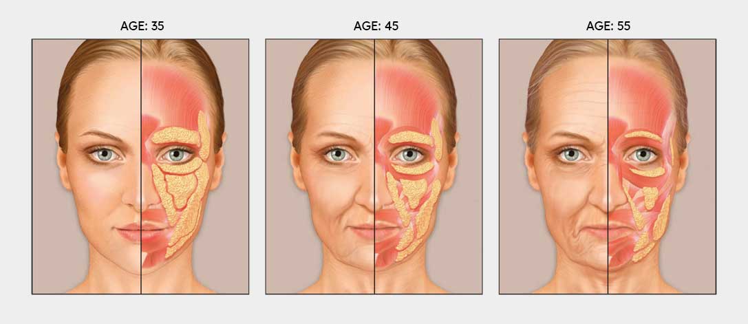 Facial aging anatomy
