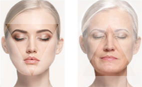 Understanding facial aging - Old woman face and young woman face