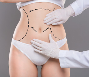 Body lift surgery