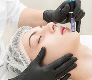 Med Spa - Microneedling PRP