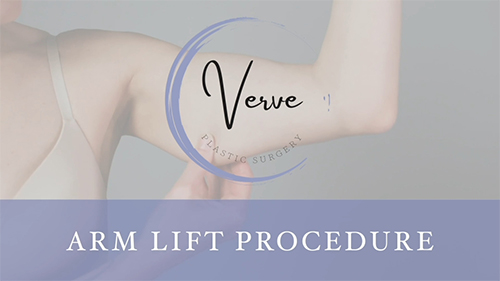 VDO Cover Procedure - Arm Lift