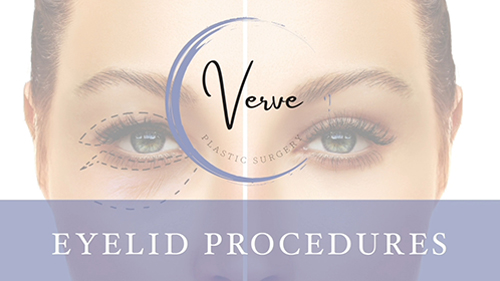 VDO Cover Procedure - Eyelid Surgery