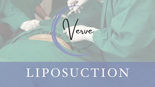 VDO Cover Procedure - Liposuction