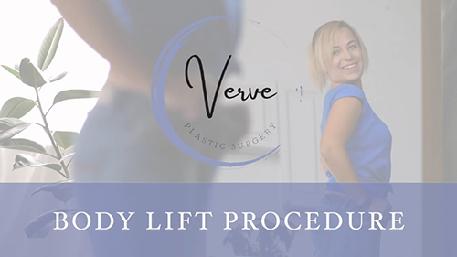 VDO Cover Procedure - Body Lift